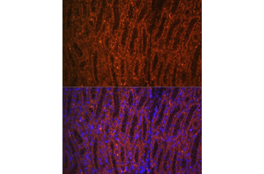 Immunofluorescence - Anti-PCK1/PEPC Antibody (A13826) - Antibodies.com