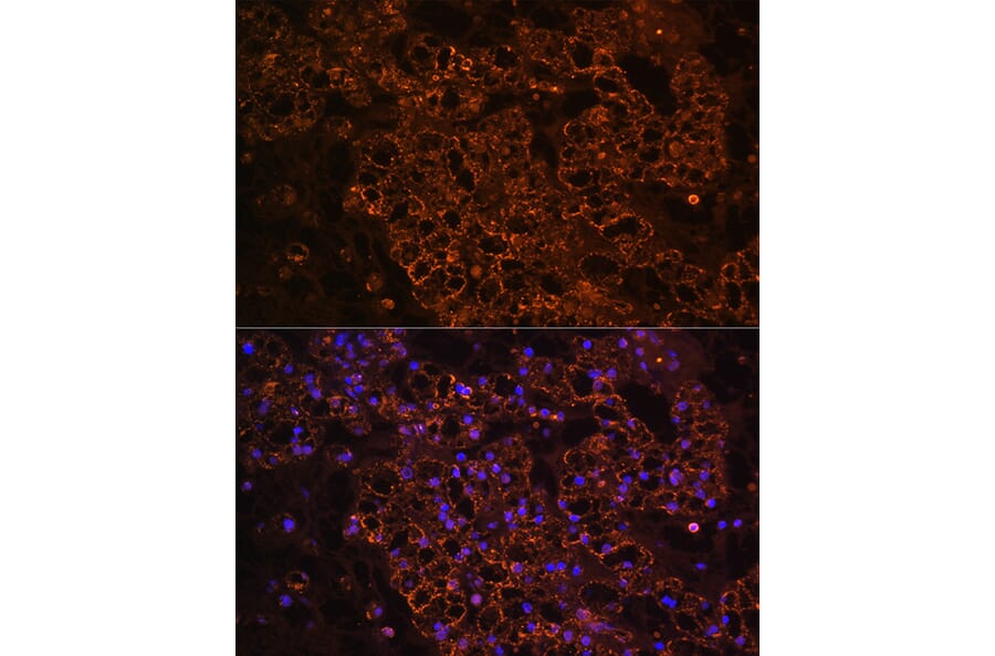 Immunofluorescence - Anti-PCK1/PEPC Antibody (A13826) - Antibodies.com