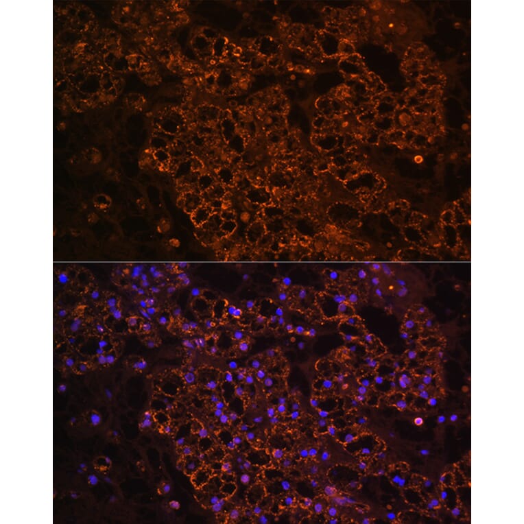 Immunofluorescence - Anti-PCK1/PEPC Antibody (A13826) - Antibodies.com