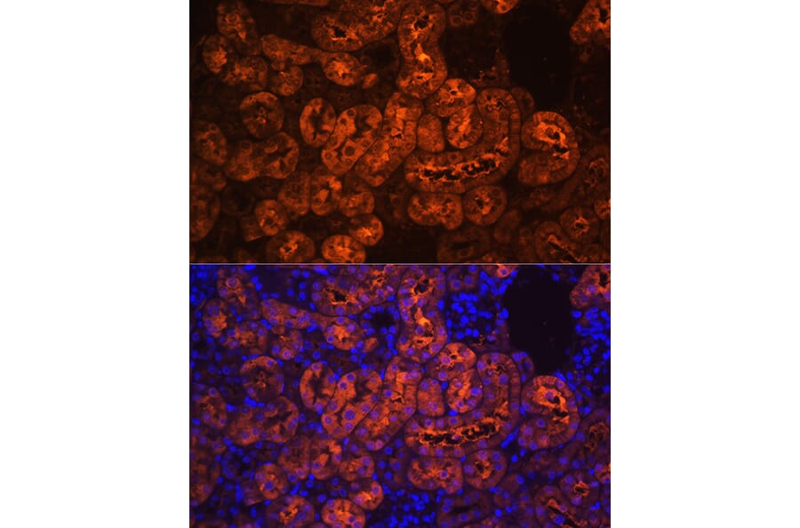 Immunofluorescence - Anti-PCK1/PEPC Antibody (A13826) - Antibodies.com