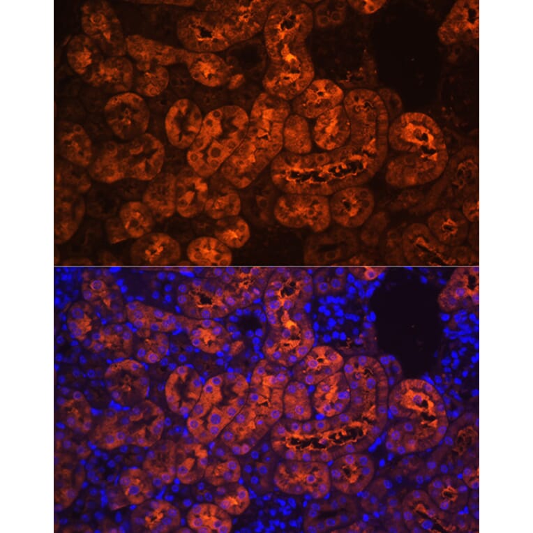 Immunofluorescence - Anti-PCK1/PEPC Antibody (A13826) - Antibodies.com