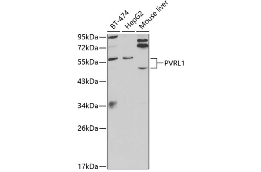 Western Blot - Anti-PVRL1/NECTIN1 Antibody (A13827) - Antibodies.com
