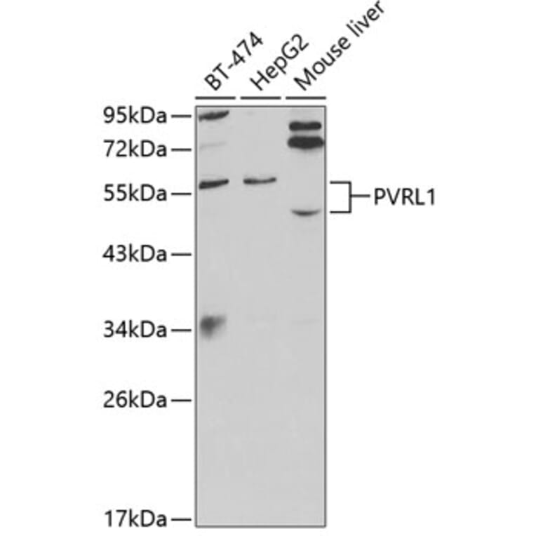 Western Blot - Anti-PVRL1/NECTIN1 Antibody (A13827) - Antibodies.com
