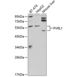 Western Blot - Anti-PVRL1/NECTIN1 Antibody (A13827) - Antibodies.com