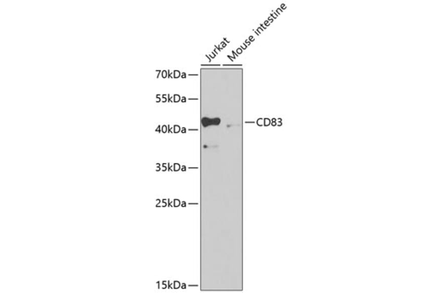 Western Blot - Anti-CD83 Antibody (A13828) - Antibodies.com