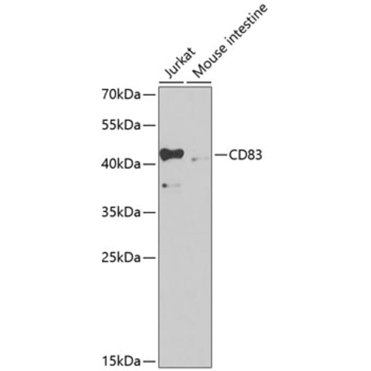 Western Blot - Anti-CD83 Antibody (A13828) - Antibodies.com
