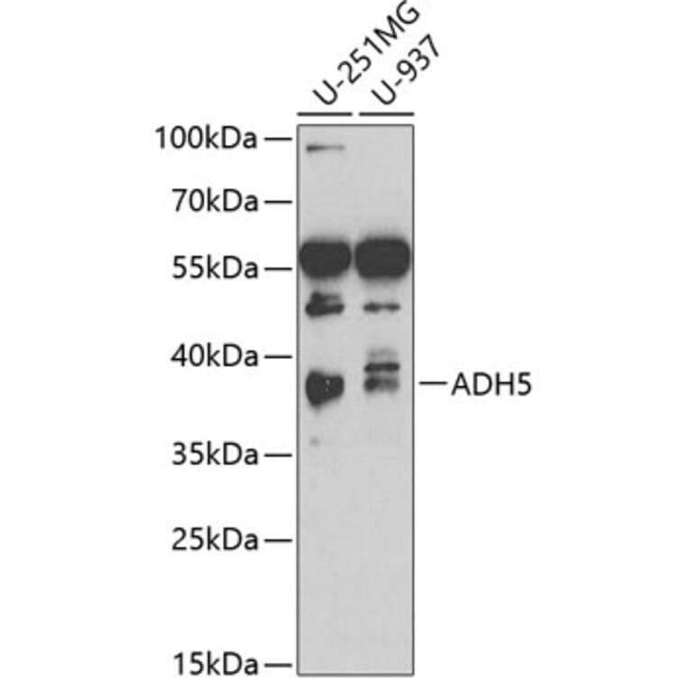 Western Blot - Anti-ADH5 Antibody (A13829) - Antibodies.com