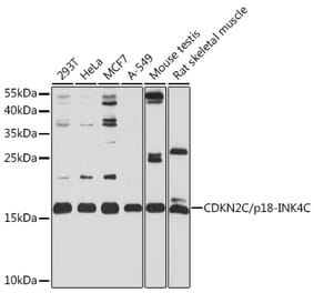 Western Blot - Anti-CDKN2C Antibody (A13830) - Antibodies.com