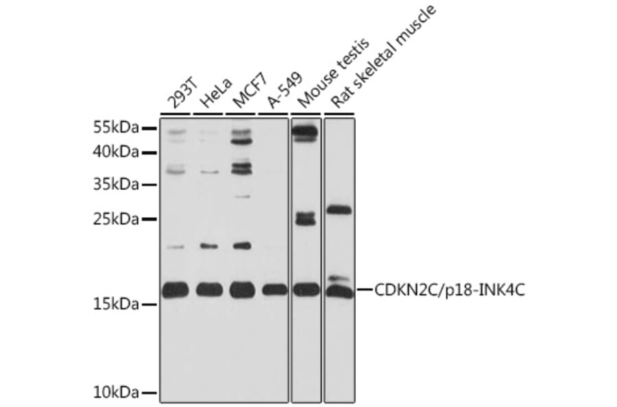 Western Blot - Anti-CDKN2C Antibody (A13830) - Antibodies.com