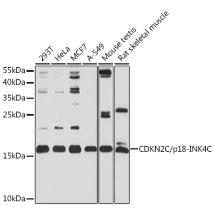 Western Blot - Anti-CDKN2C Antibody (A13830) - Antibodies.com