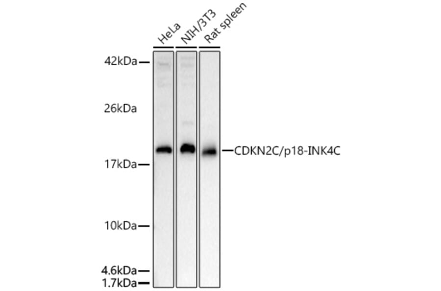 Western Blot - Anti-CDKN2C Antibody (A13830) - Antibodies.com