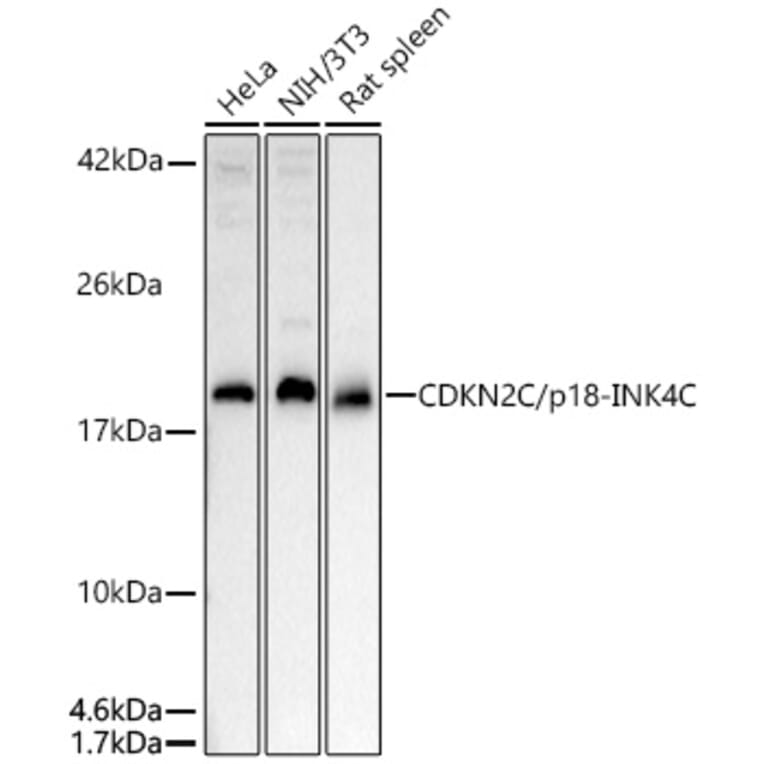 Western Blot - Anti-CDKN2C Antibody (A13830) - Antibodies.com