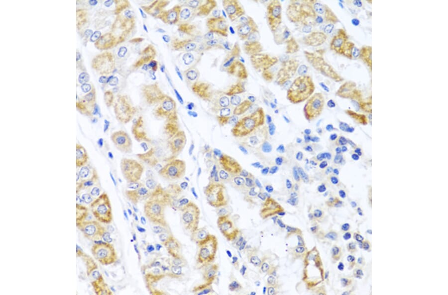 Immunohistochemistry - Anti-CDKN2C Antibody (A13830) - Antibodies.com