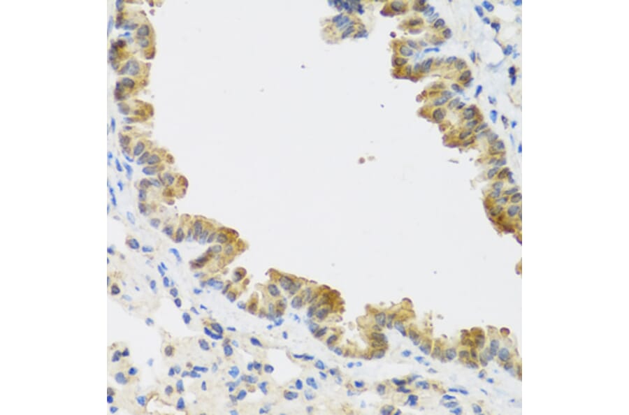 Immunohistochemistry - Anti-CDKN2C Antibody (A13830) - Antibodies.com