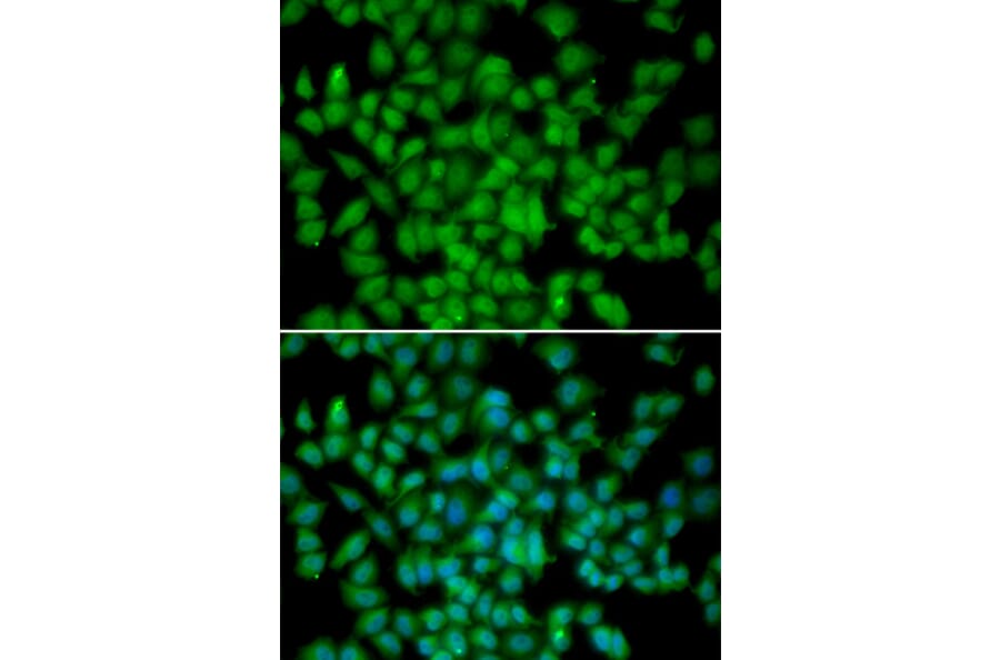 Immunofluorescence - Anti-CDKN2C Antibody (A13830) - Antibodies.com