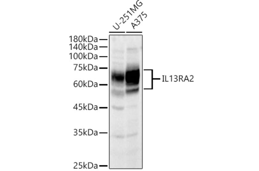 Western Blot - Anti-IL-13 receptor alpha 2 Antibody (A13831) - Antibodies.com
