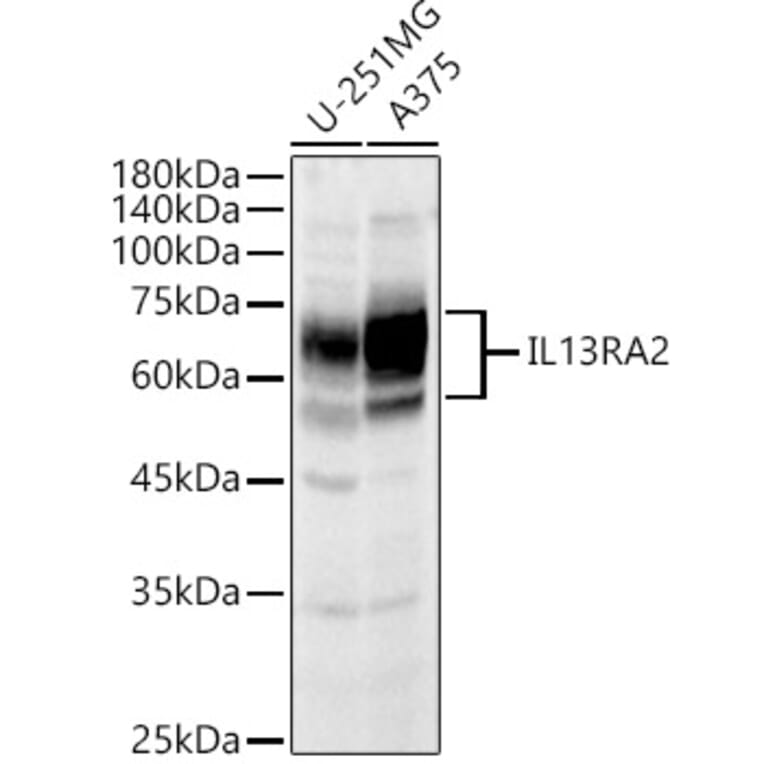 Western Blot - Anti-IL-13 receptor alpha 2 Antibody (A13831) - Antibodies.com