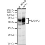 Western Blot - Anti-IL-13 receptor alpha 2 Antibody (A13831) - Antibodies.com