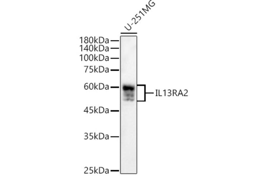 Western Blot - Anti-IL-13 receptor alpha 2 Antibody (A13831) - Antibodies.com