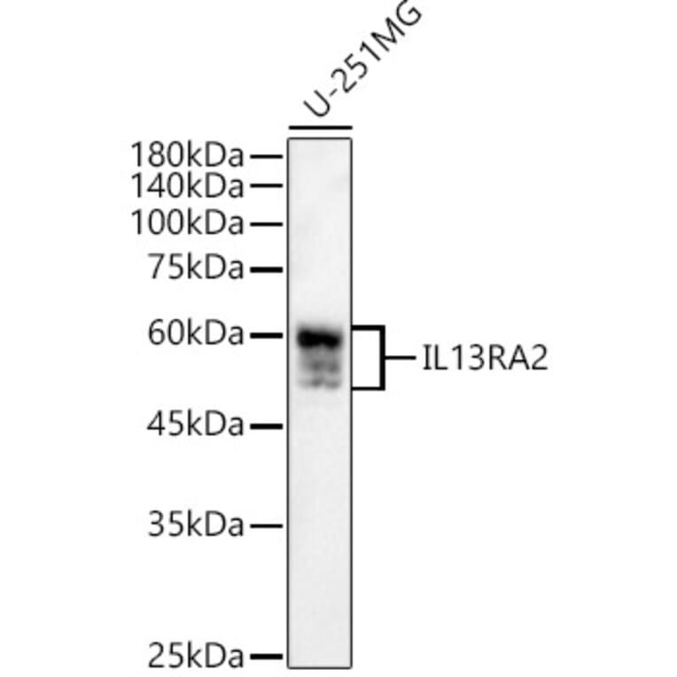Western Blot - Anti-IL-13 receptor alpha 2 Antibody (A13831) - Antibodies.com