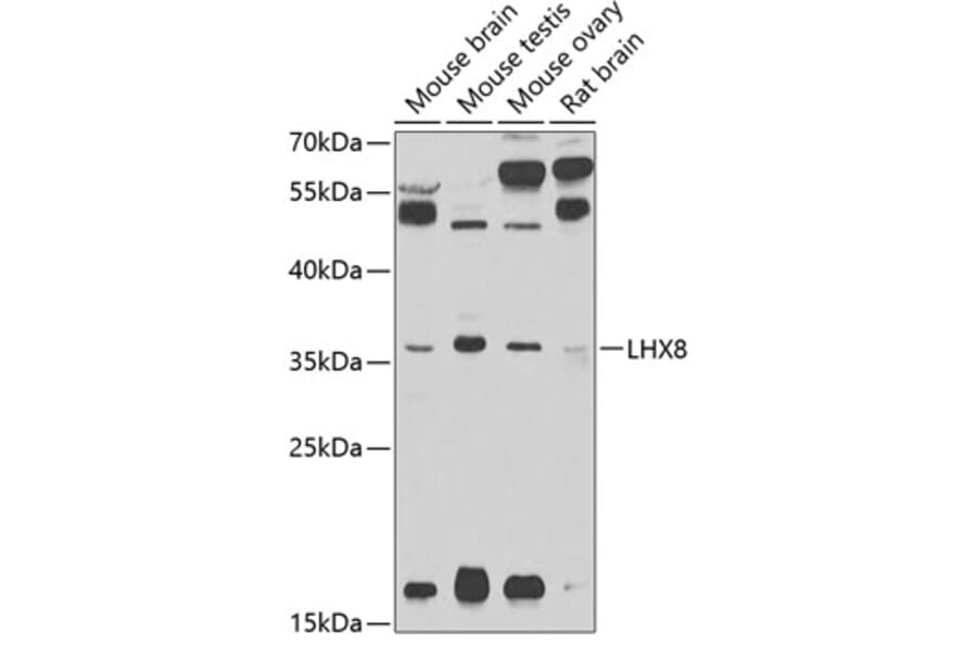 Western Blot - Anti-Lhx8 Antibody (A13832) - Antibodies.com