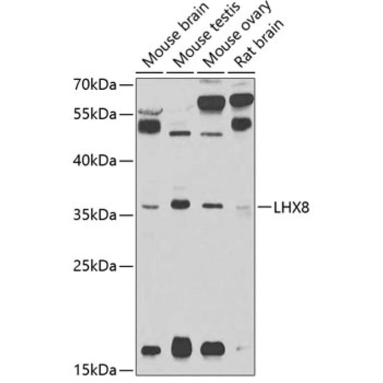 Western Blot - Anti-Lhx8 Antibody (A13832) - Antibodies.com