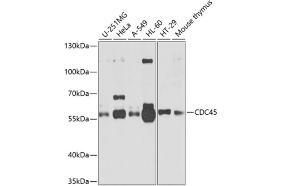 Western Blot - Anti-CDC45L Antibody (A13833) - Antibodies.com