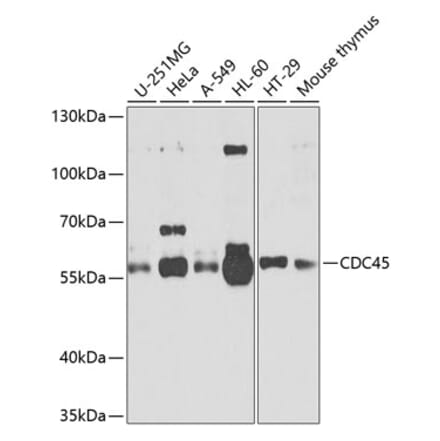 Western Blot - Anti-CDC45L Antibody (A13833) - Antibodies.com