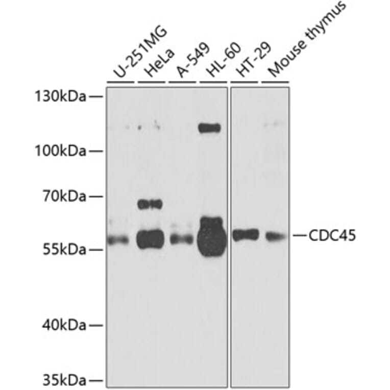 Western Blot - Anti-CDC45L Antibody (A13833) - Antibodies.com