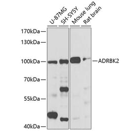 Western Blot - Anti-GRK3 Antibody (A13834) - Antibodies.com