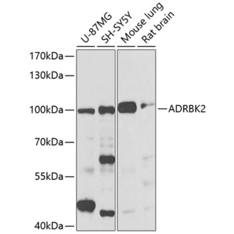 Western Blot - Anti-GRK3 Antibody (A13834) - Antibodies.com