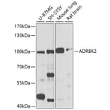 Western Blot - Anti-GRK3 Antibody (A13834) - Antibodies.com