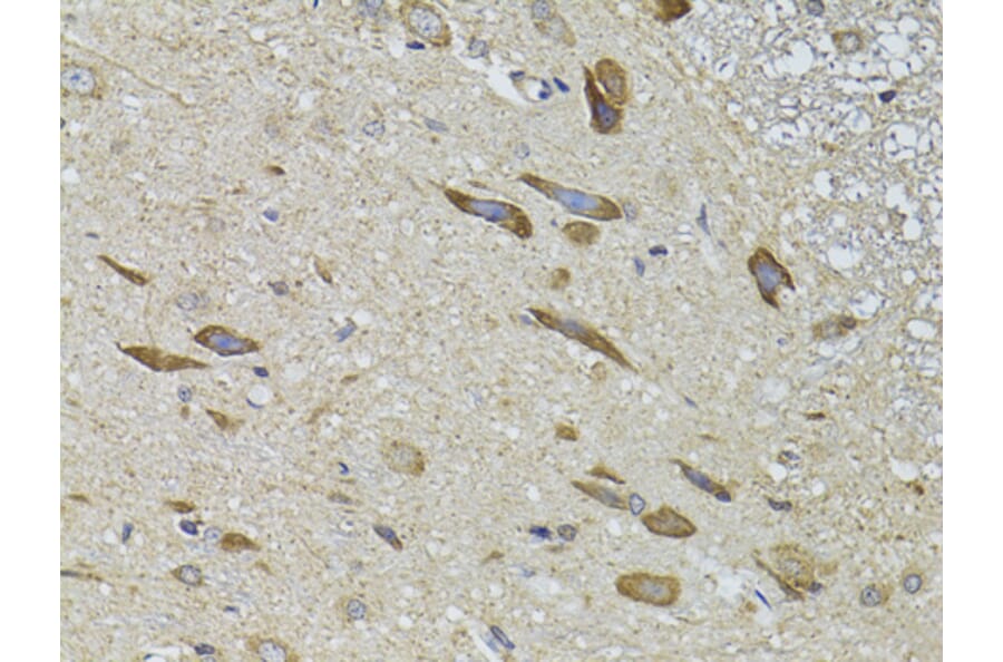 Immunohistochemistry - Anti-GRK3 Antibody (A13834) - Antibodies.com