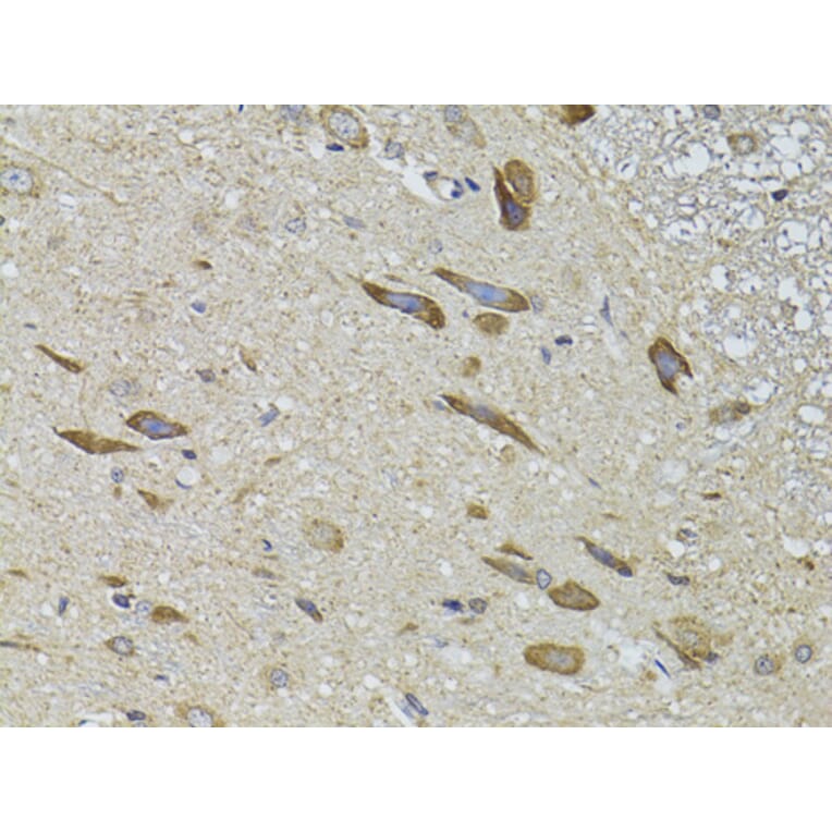 Immunohistochemistry - Anti-GRK3 Antibody (A13834) - Antibodies.com