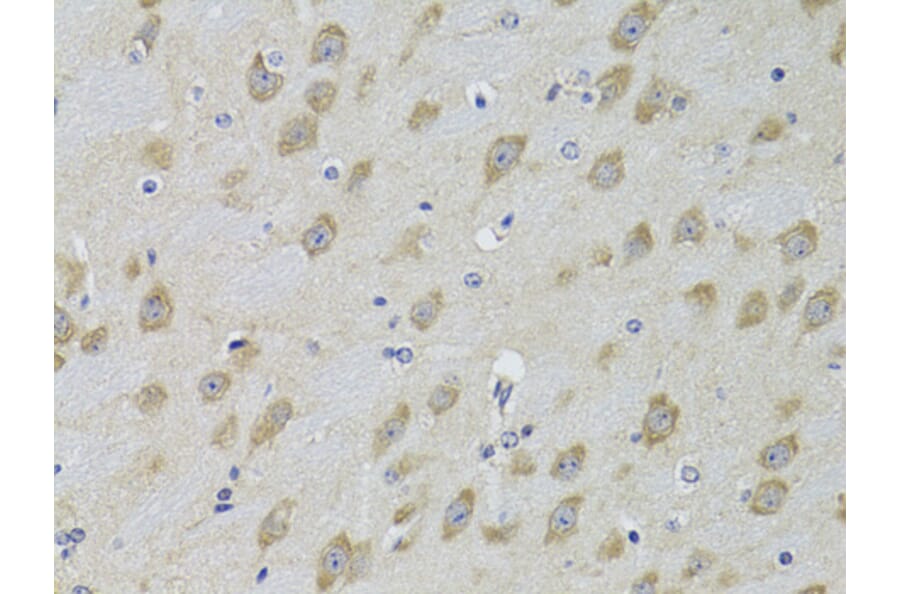 Immunohistochemistry - Anti-GRK3 Antibody (A13834) - Antibodies.com