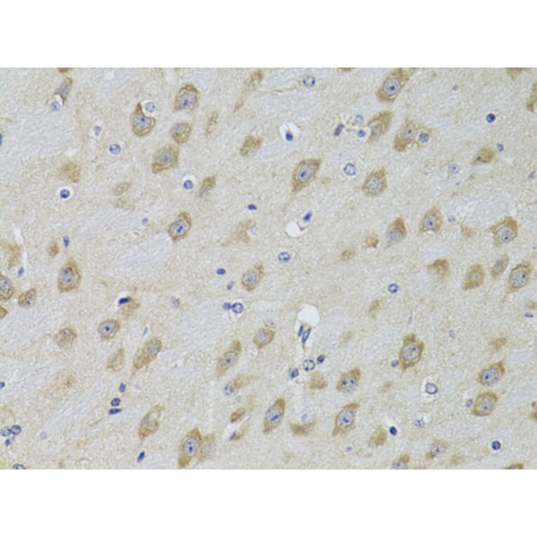 Immunohistochemistry - Anti-GRK3 Antibody (A13834) - Antibodies.com