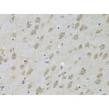 Immunohistochemistry - Anti-GRK3 Antibody (A13834) - Antibodies.com