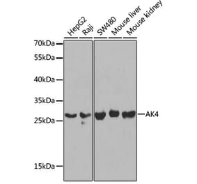 Western Blot - Anti-AK3L1 Antibody (A13835) - Antibodies.com