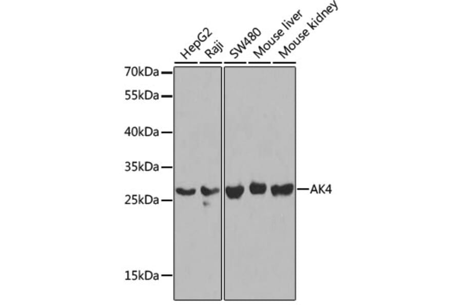 Western Blot - Anti-AK3L1 Antibody (A13835) - Antibodies.com