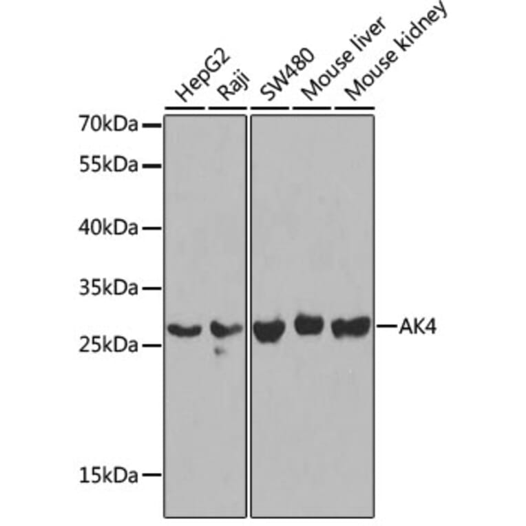 Western Blot - Anti-AK3L1 Antibody (A13835) - Antibodies.com