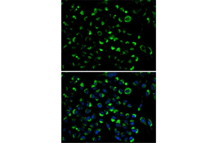 Immunofluorescence - Anti-AK3L1 Antibody (A13835) - Antibodies.com
