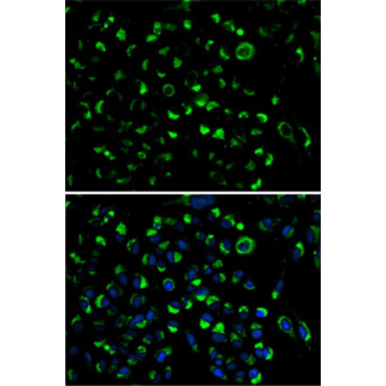 Immunofluorescence - Anti-AK3L1 Antibody (A13835) - Antibodies.com