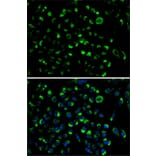 Immunofluorescence - Anti-AK3L1 Antibody (A13835) - Antibodies.com