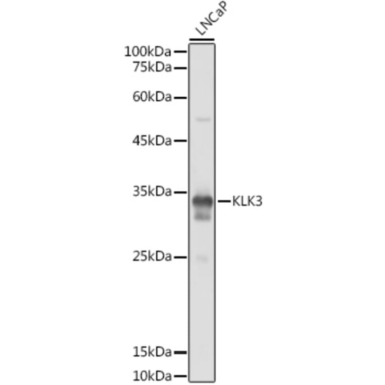 Western Blot - Anti-Prostate Specific Antigen Antibody (A13836) - Antibodies.com