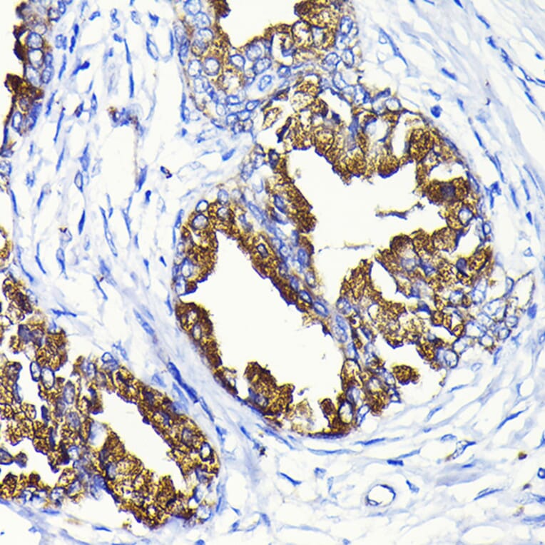 Immunohistochemistry - Anti-Prostate Specific Antigen Antibody (A13836) - Antibodies.com