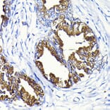 Immunohistochemistry - Anti-Prostate Specific Antigen Antibody (A13836) - Antibodies.com