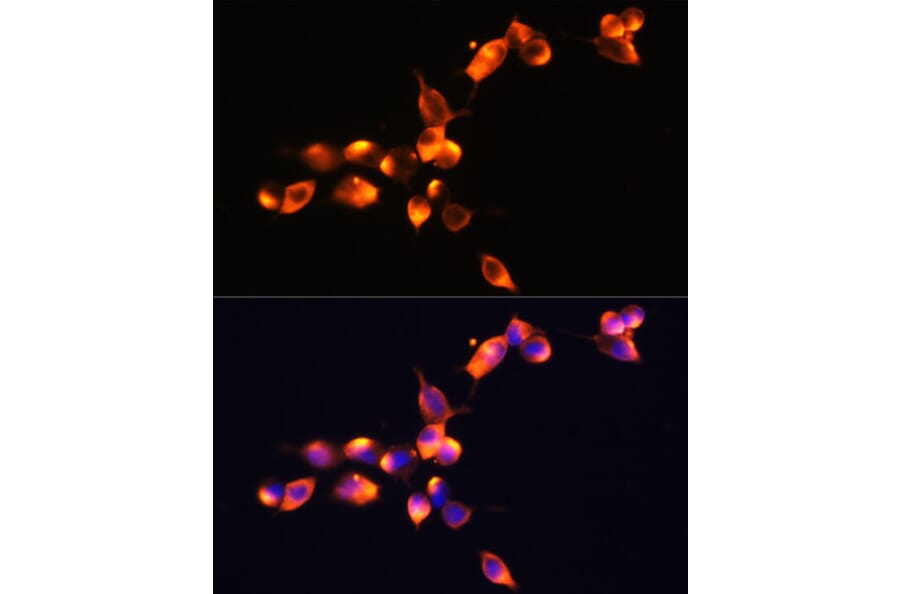 Immunofluorescence - Anti-Prostate Specific Antigen Antibody (A13836) - Antibodies.com