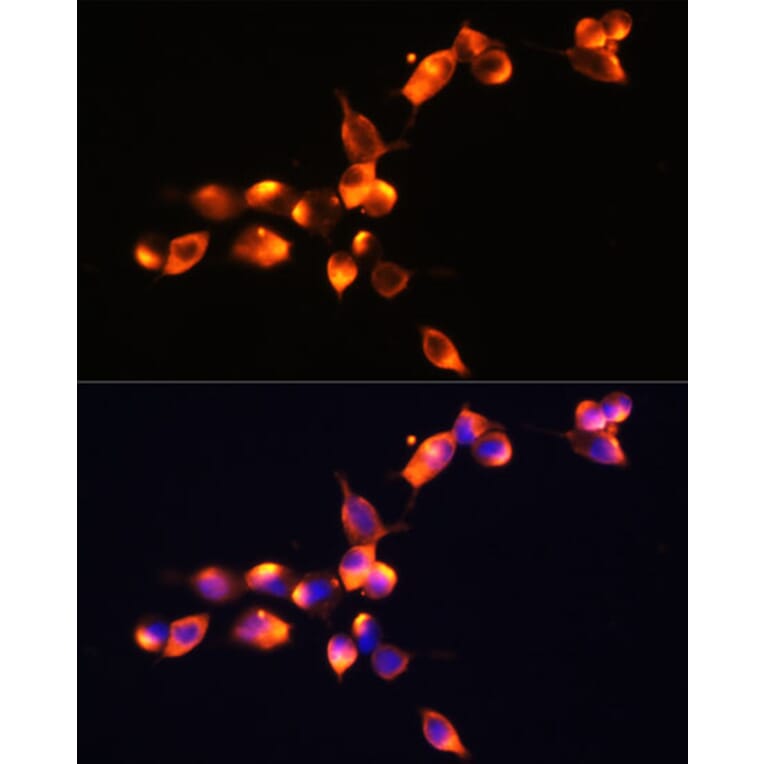 Immunofluorescence - Anti-Prostate Specific Antigen Antibody (A13836) - Antibodies.com