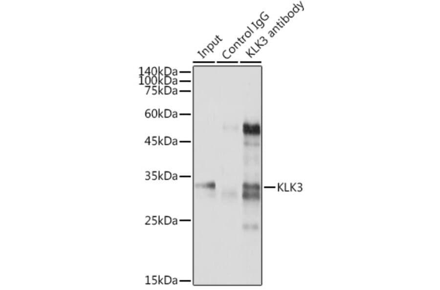 Western Blot - Anti-Prostate Specific Antigen Antibody (A13836) - Antibodies.com