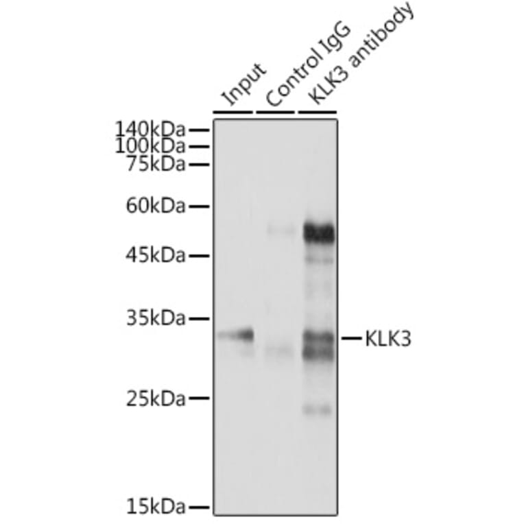 Western Blot - Anti-Prostate Specific Antigen Antibody (A13836) - Antibodies.com